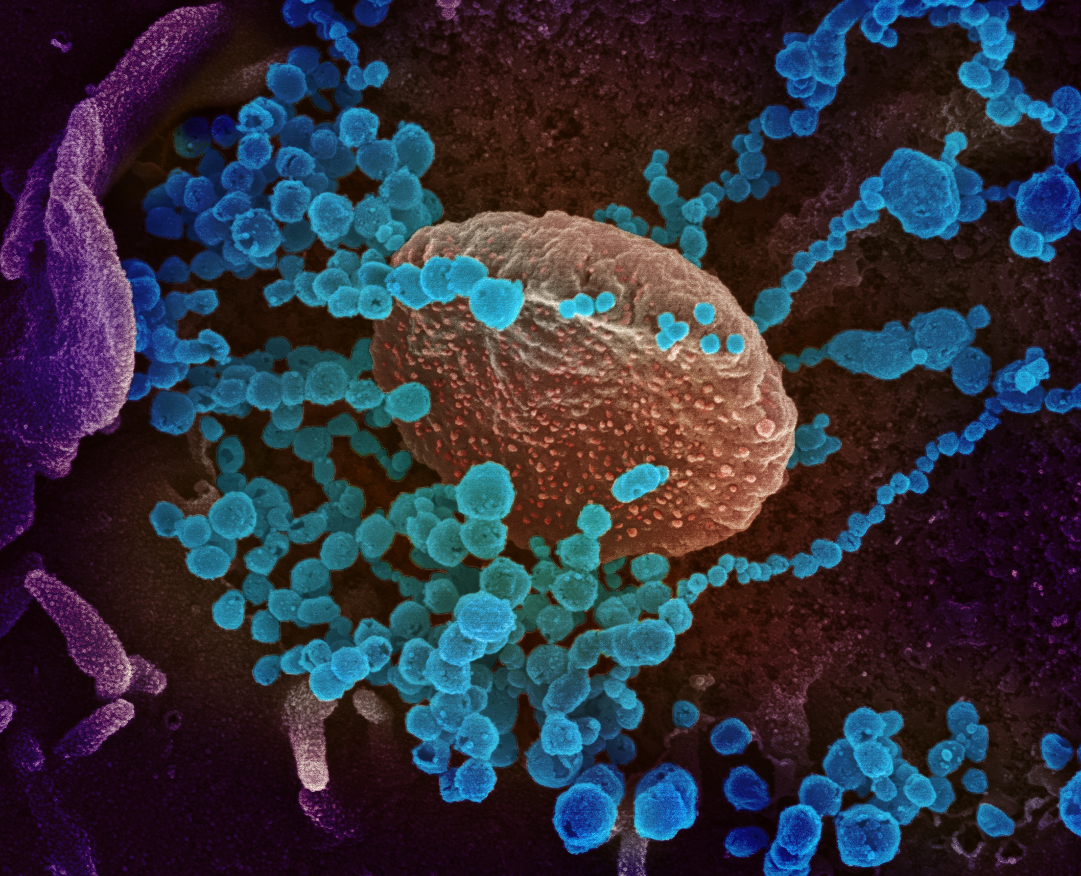 Microscopic view of numerous particles of SARS-CoV-2 labeled blue emerging from an infected cell.