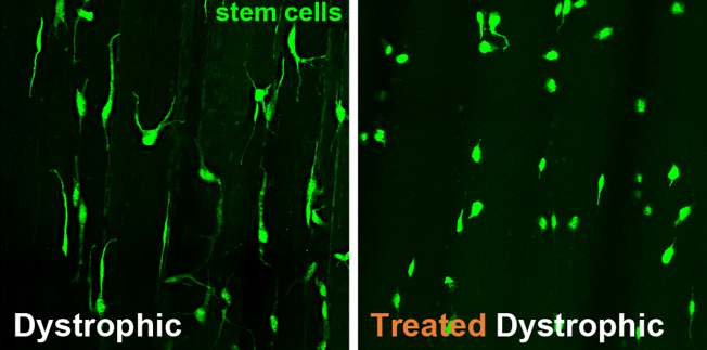 Microscopic view of stem cells side by side, one before treatment one after.