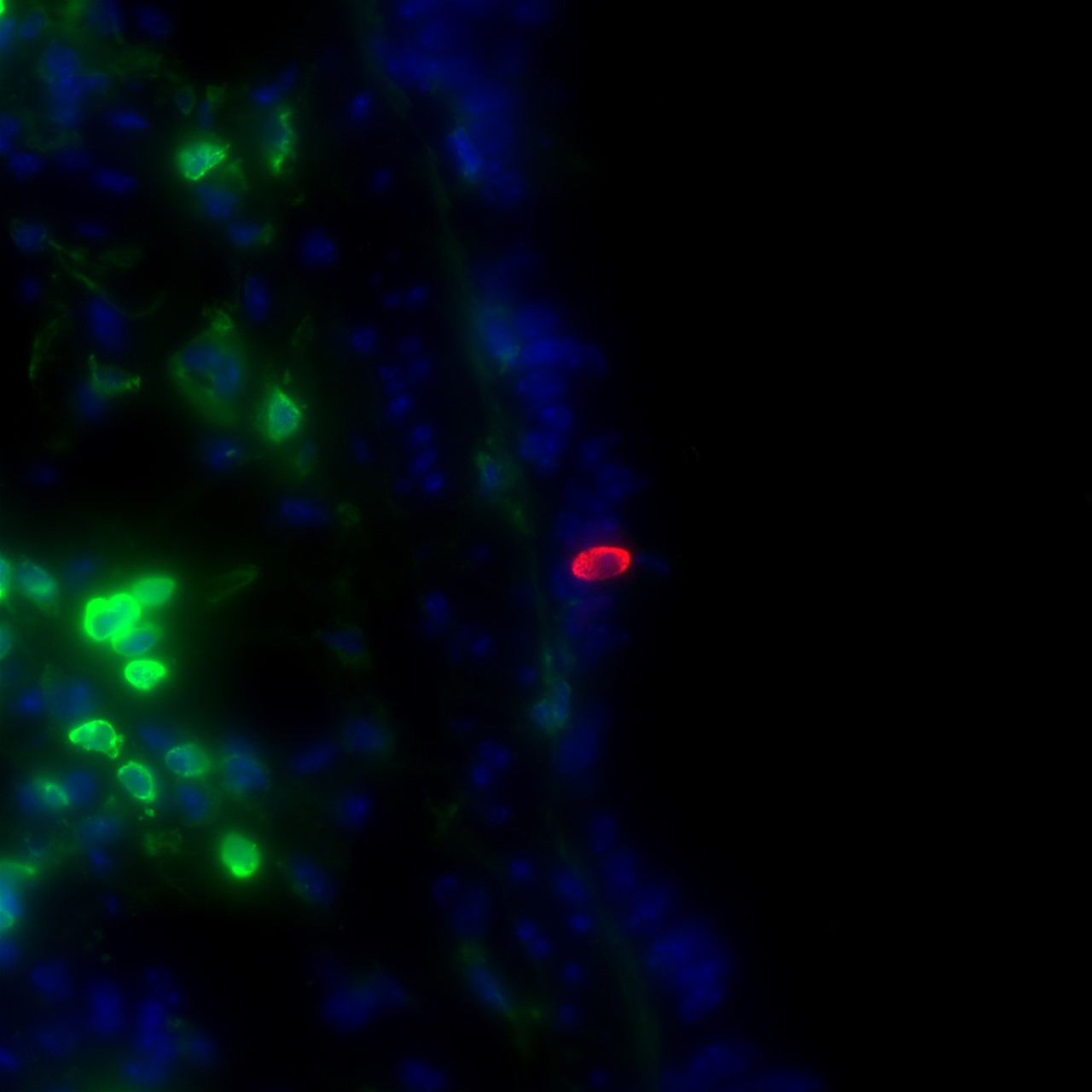 A red blob indicates SARS-CoV-2 infection in a mouse lung, with nearby immune cells in green