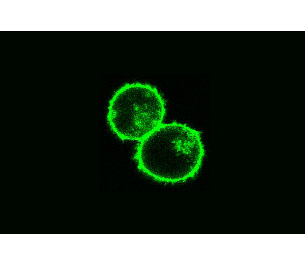 image of two fuzzy green rings touching represent two T cells 
