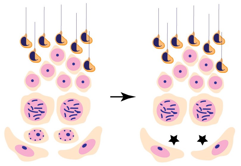 Illustration of different cell types that eventually give rise to sperm shows that blocking an early stage of cell development can prevent the formation of sperm