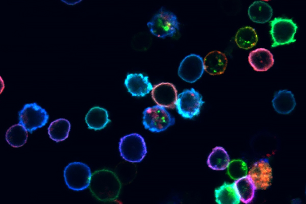 Fluorescent markers highlighting individual cells.