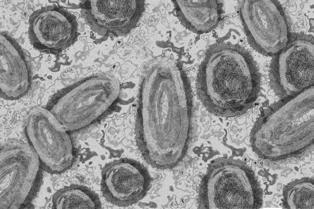 microscopic view of monkeypox virus 