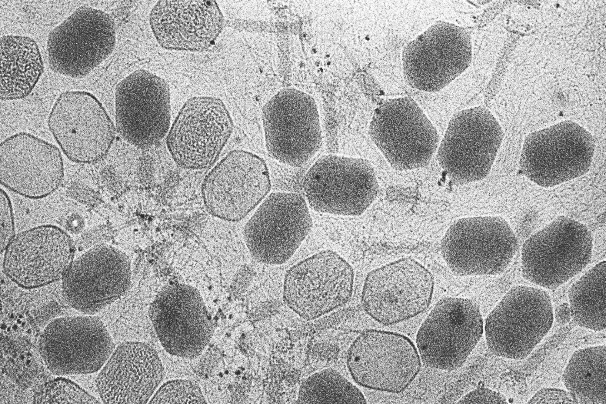 A microscope image of a group of phages 