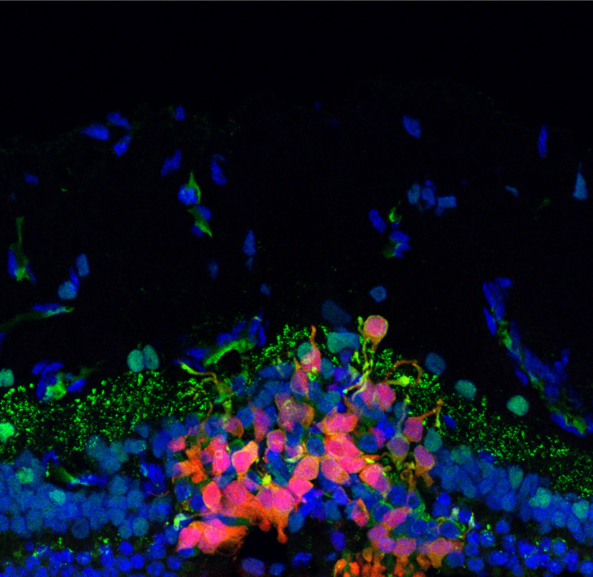 Fluorescent microscopy against a black background shows a layer of green flecks over a mix of blue and red labeled cells
