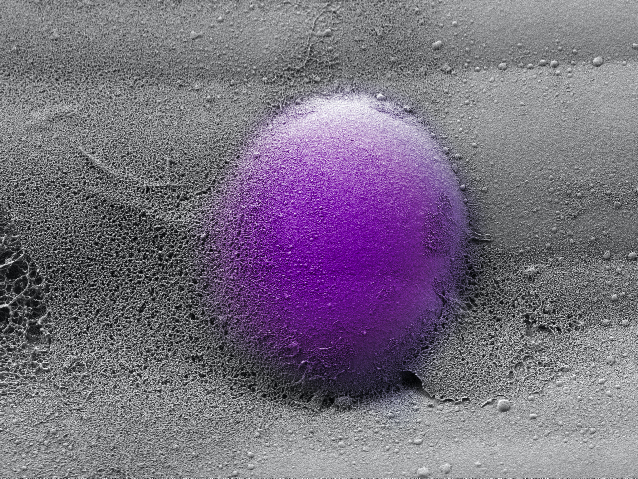 microscopic image of an immune cell labeled purple against a gray background