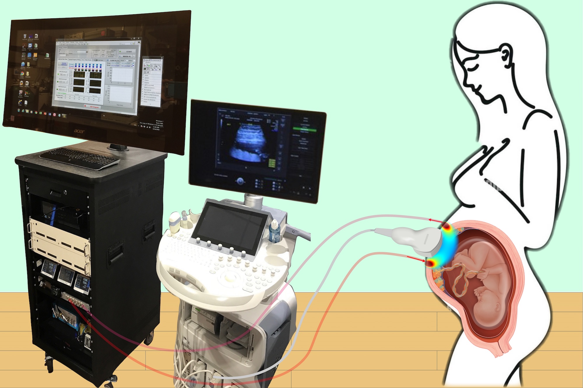 Image of pregnant person with fetus being scanned by a device connected to two computers