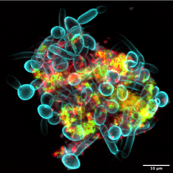 Microscopie image of a group of microbes clumped together, labeled in red, blue, yellow, and green