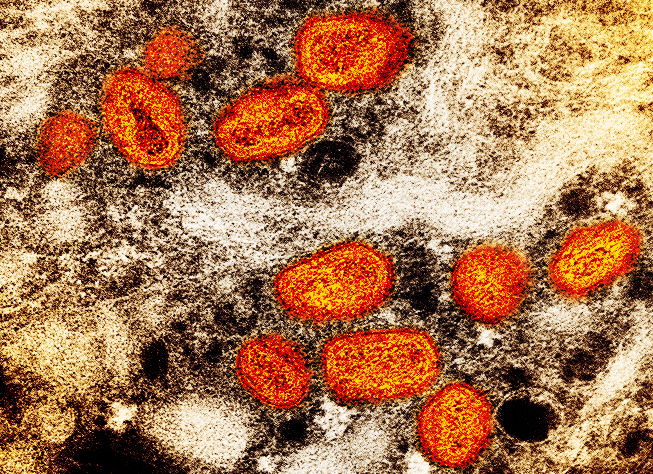 Highlighted monkeypox virus scan