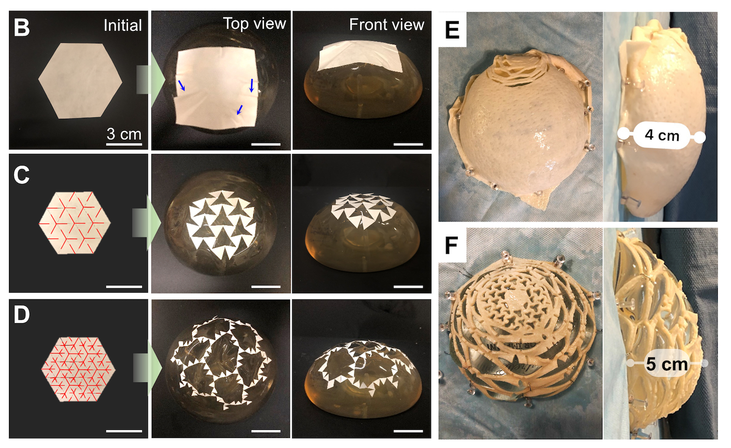Scientific figures showing kirigami design on acellular dermal matrix