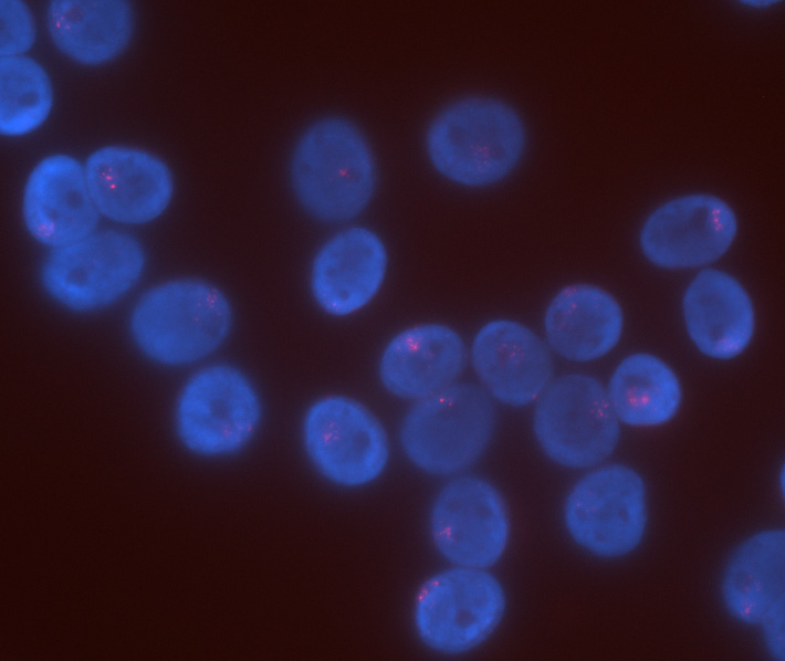 Lung cells with RNA labeled in pink in each cell