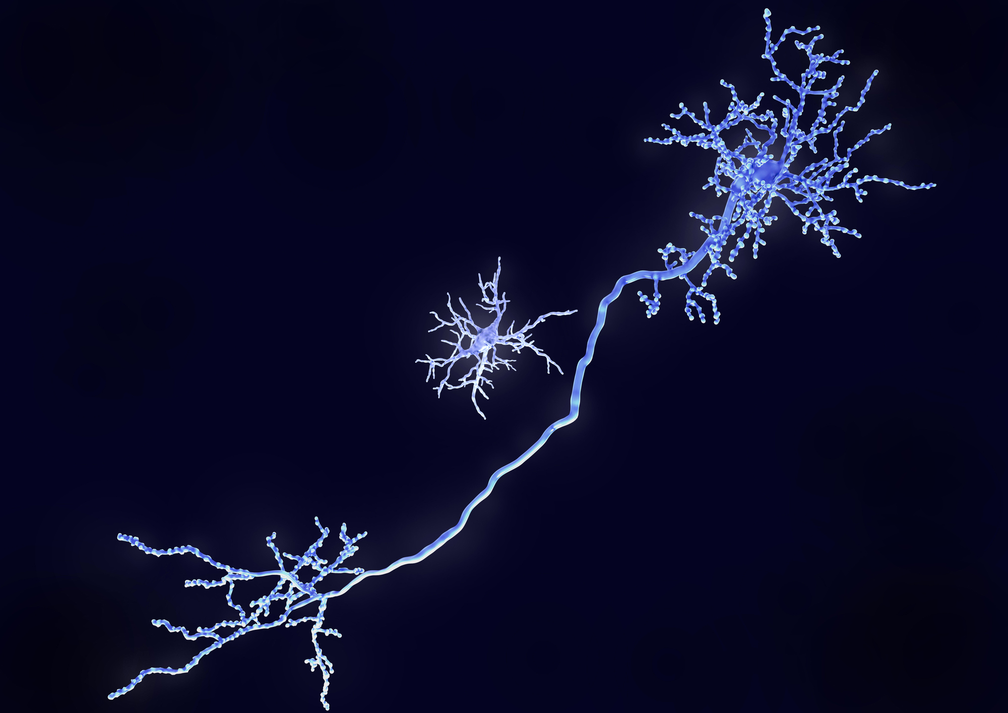 Microscopic view of Microglia cell and pyramidal neuron.