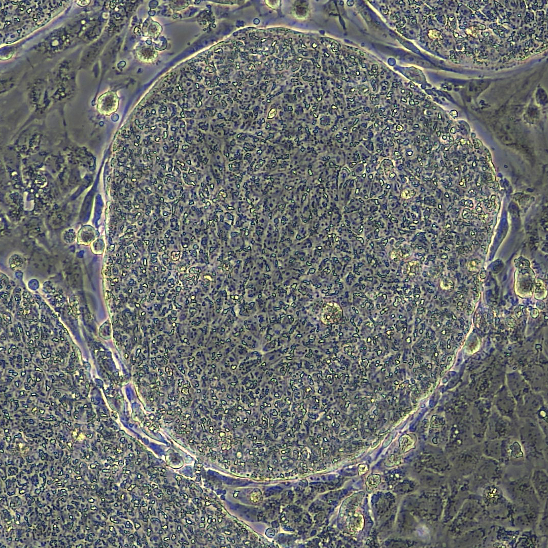 Microscopic image of a tightly packed collection of cells