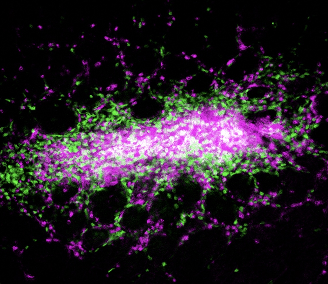 microscopic image stained with pink, green, and white, indicating a group of immune cells surrounding Yersinia bacteria