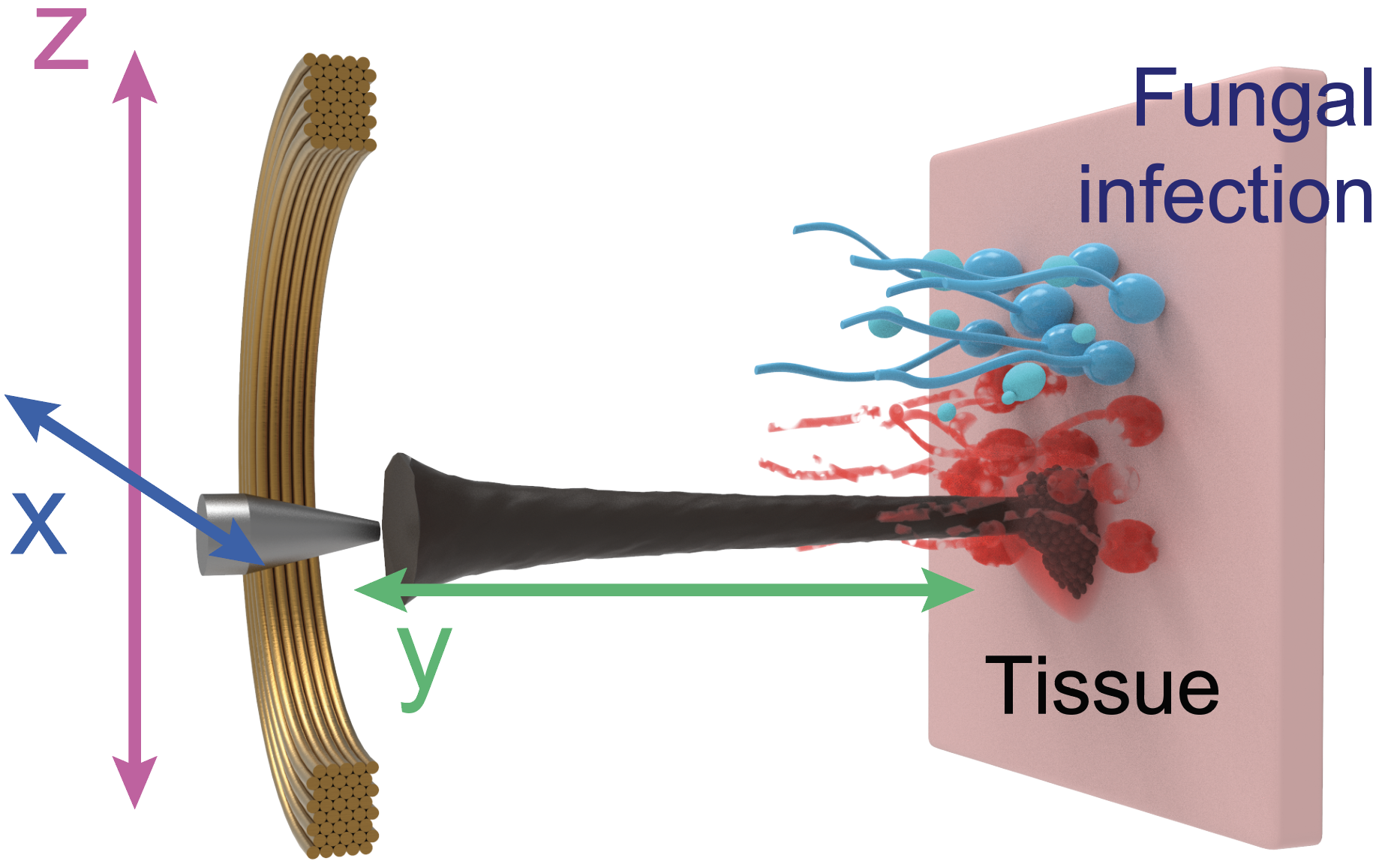 Rendering of microrobot system taergeting site of infection.
