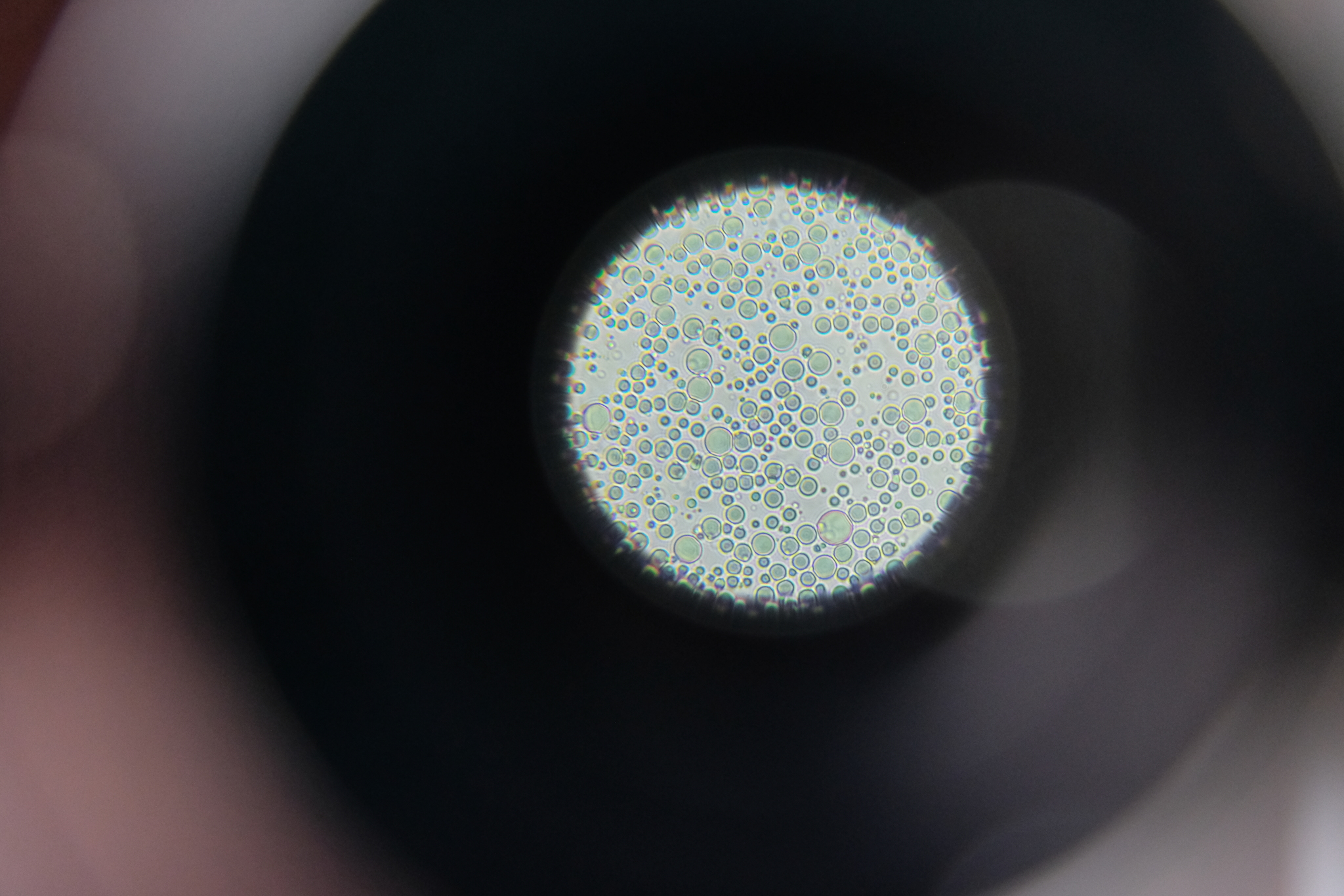 Milk globules under microscope.
