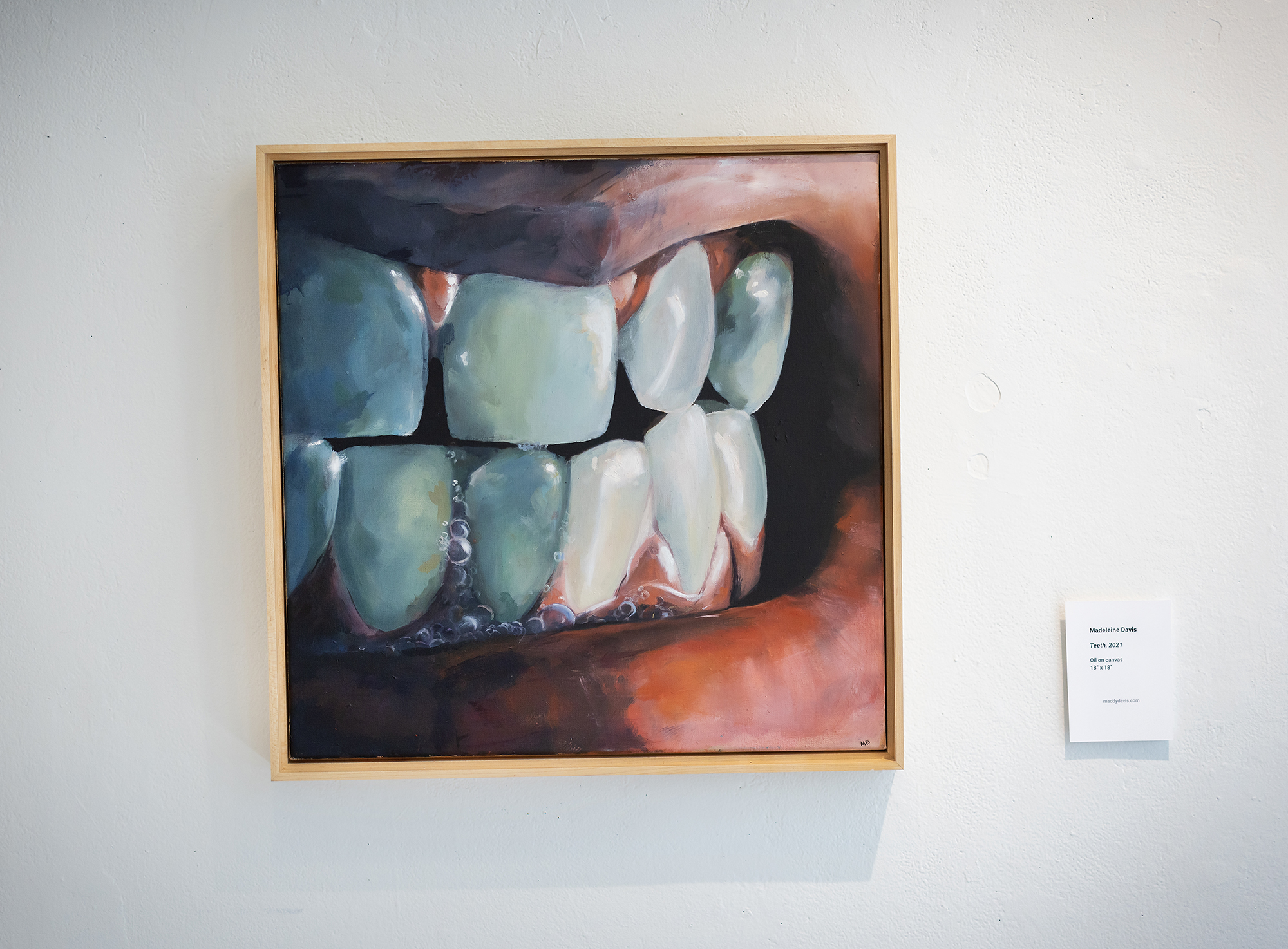 artwork depicting a closeup of clenched teeth