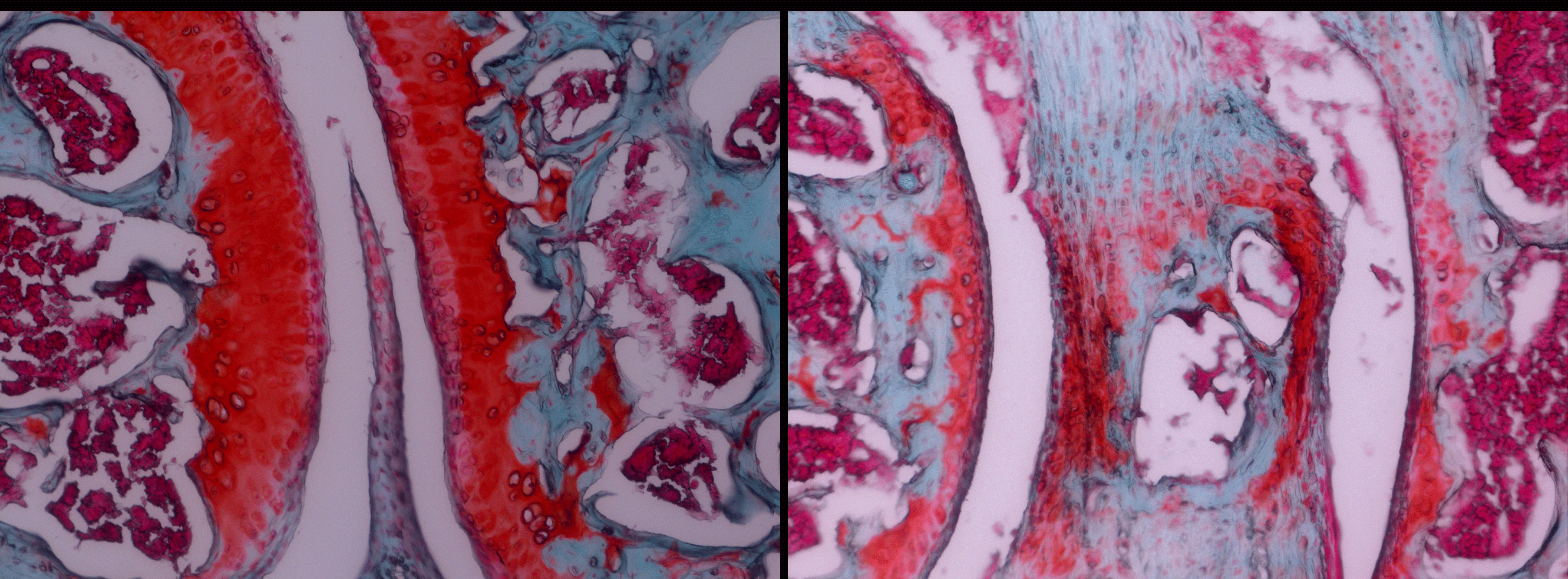 Two side by side screens pictures of imaged tissue showing cartilage loss in mice. 