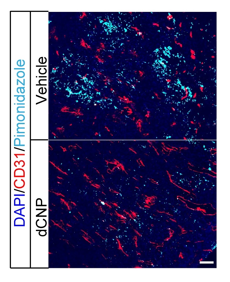 Cells within colon tumors with and without dCNP.