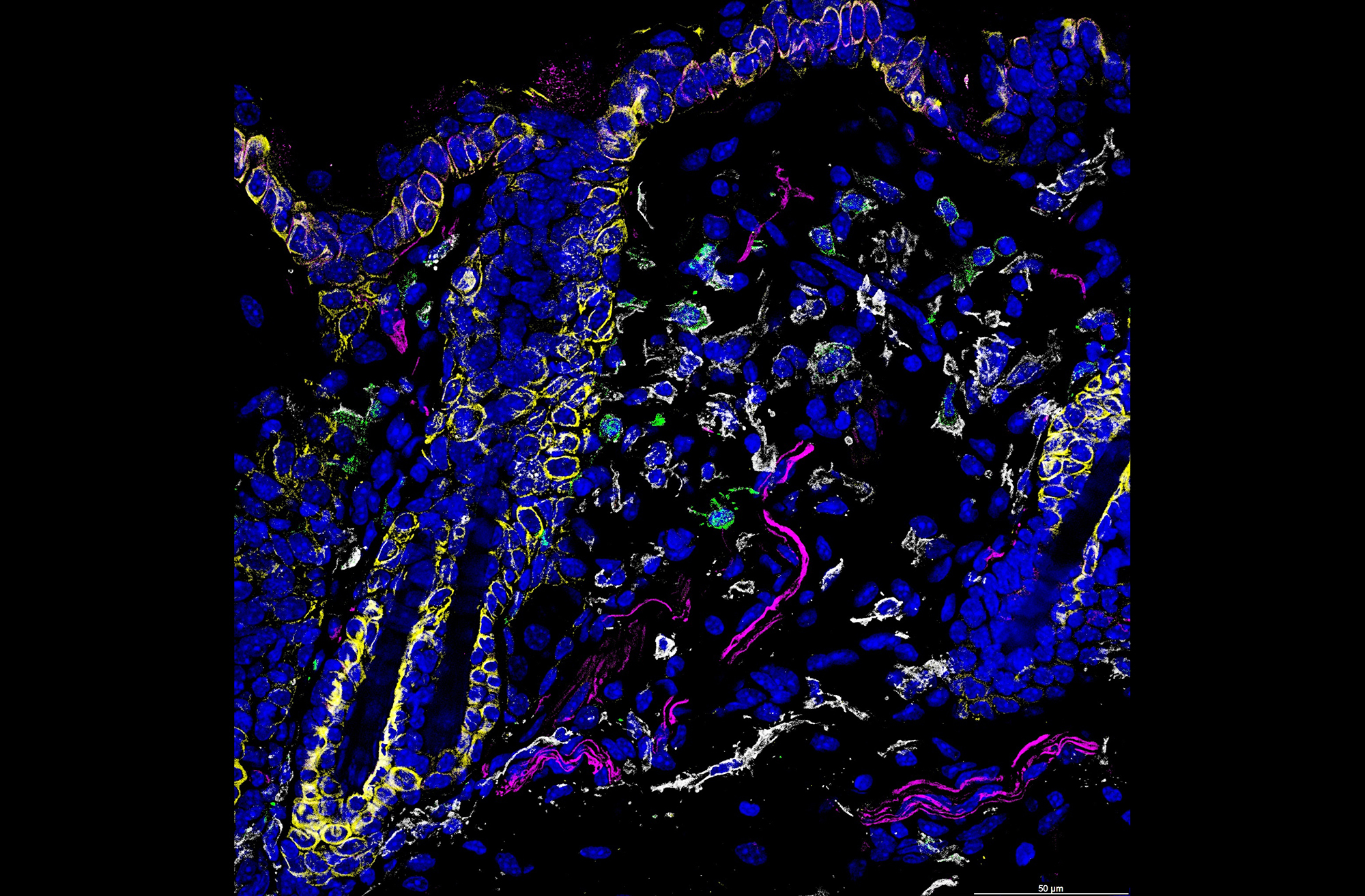 Image of immunofluorescence on nerve cells interacting with immune cells and peptides.