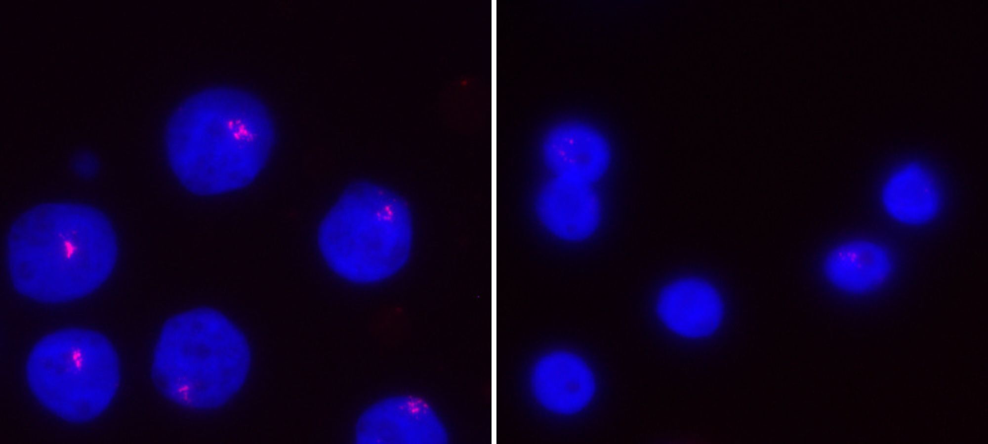 Two images of T-cells from healthy human female, untreated and treated with NF-kappa B.