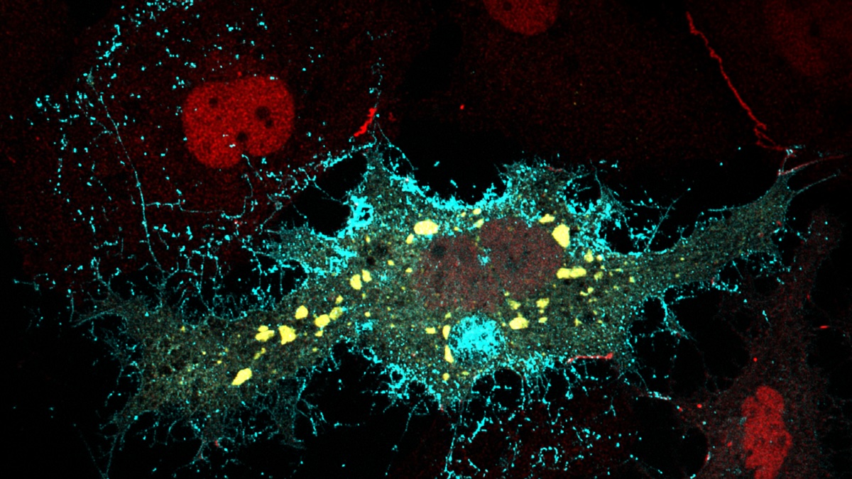 Ebola virus in cell.