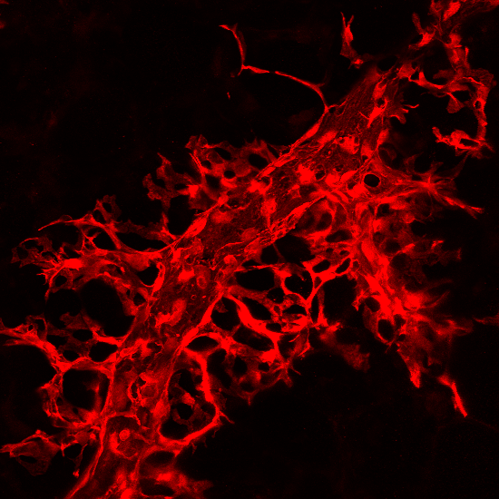 Lung veins branch into capillary bed.