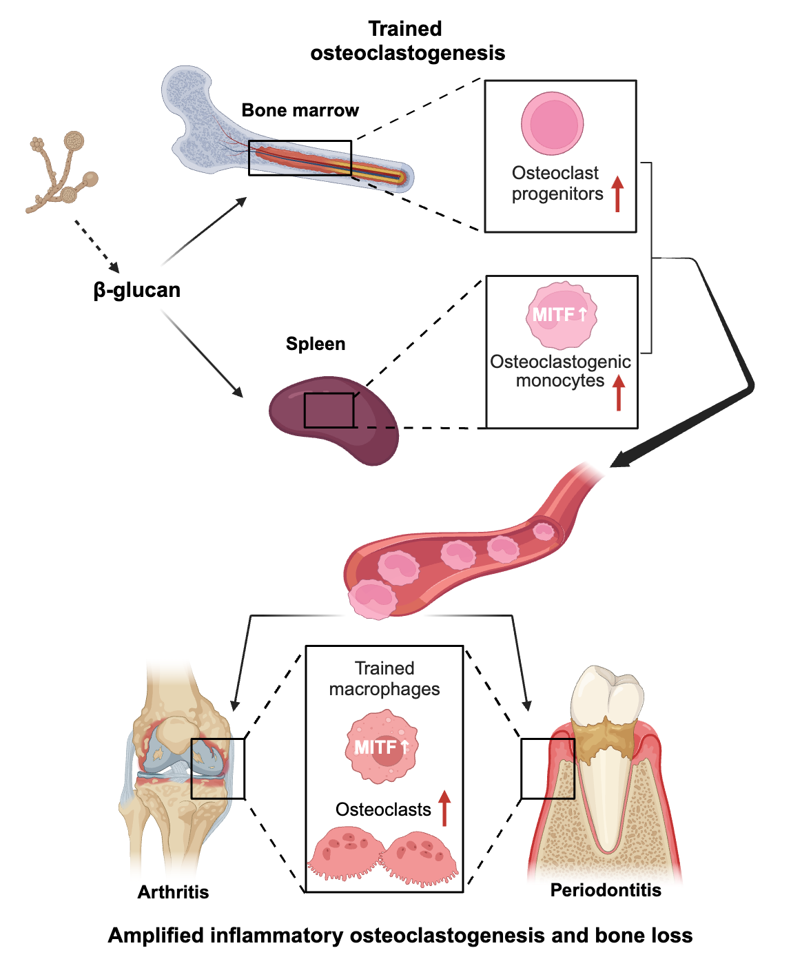 Schematic of the effects of trained immunity on osteoclast generation.