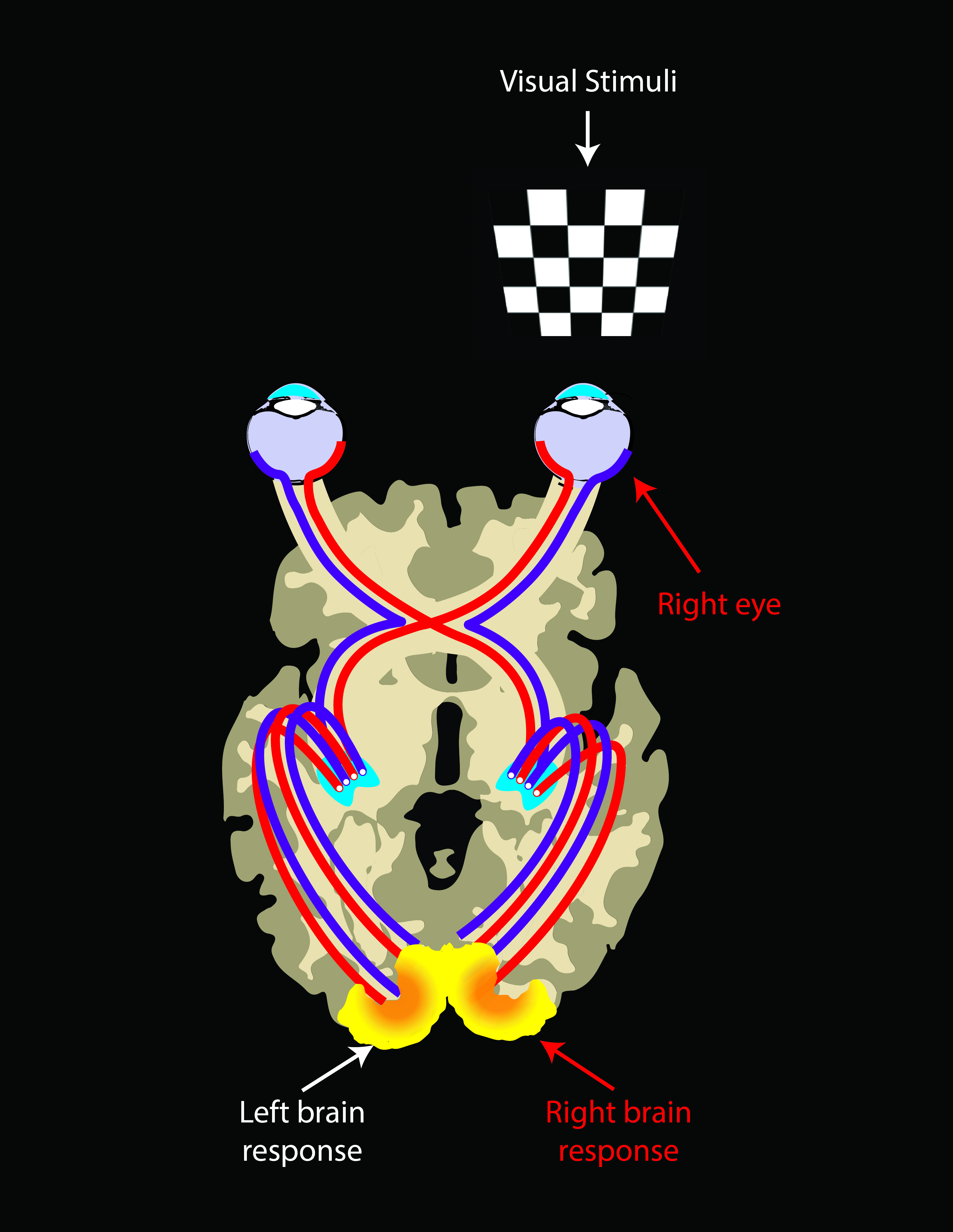 Vision Restoring Gene Therapy Also Strengthens Visual Processing