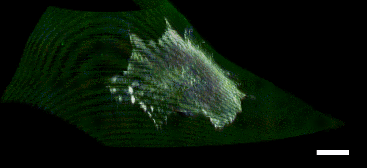 stress fibers