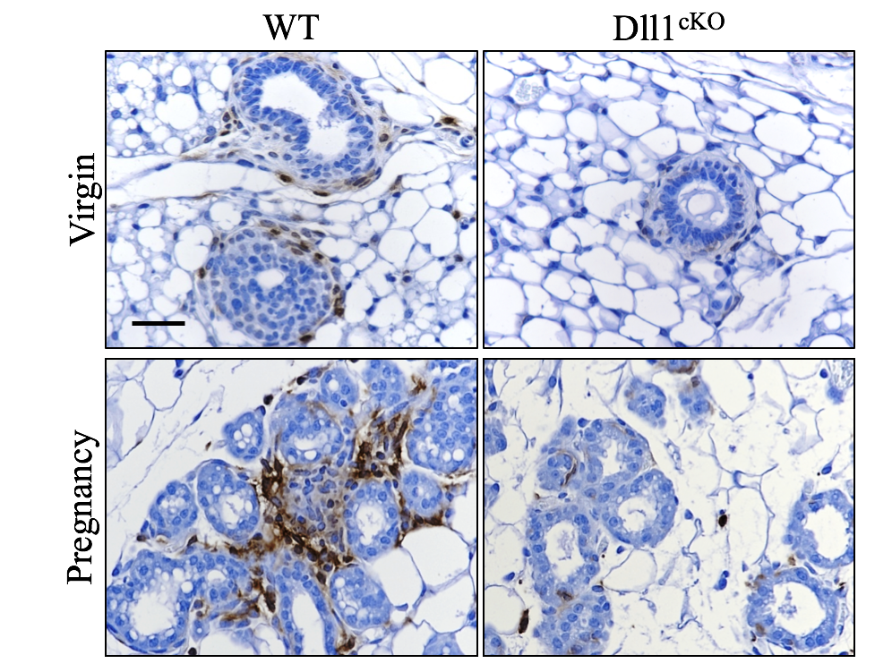 Chakrabarti.mammary stem cells.2018