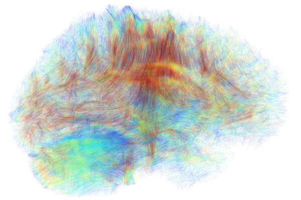 an abstract depiction of a brain in rainbow colors