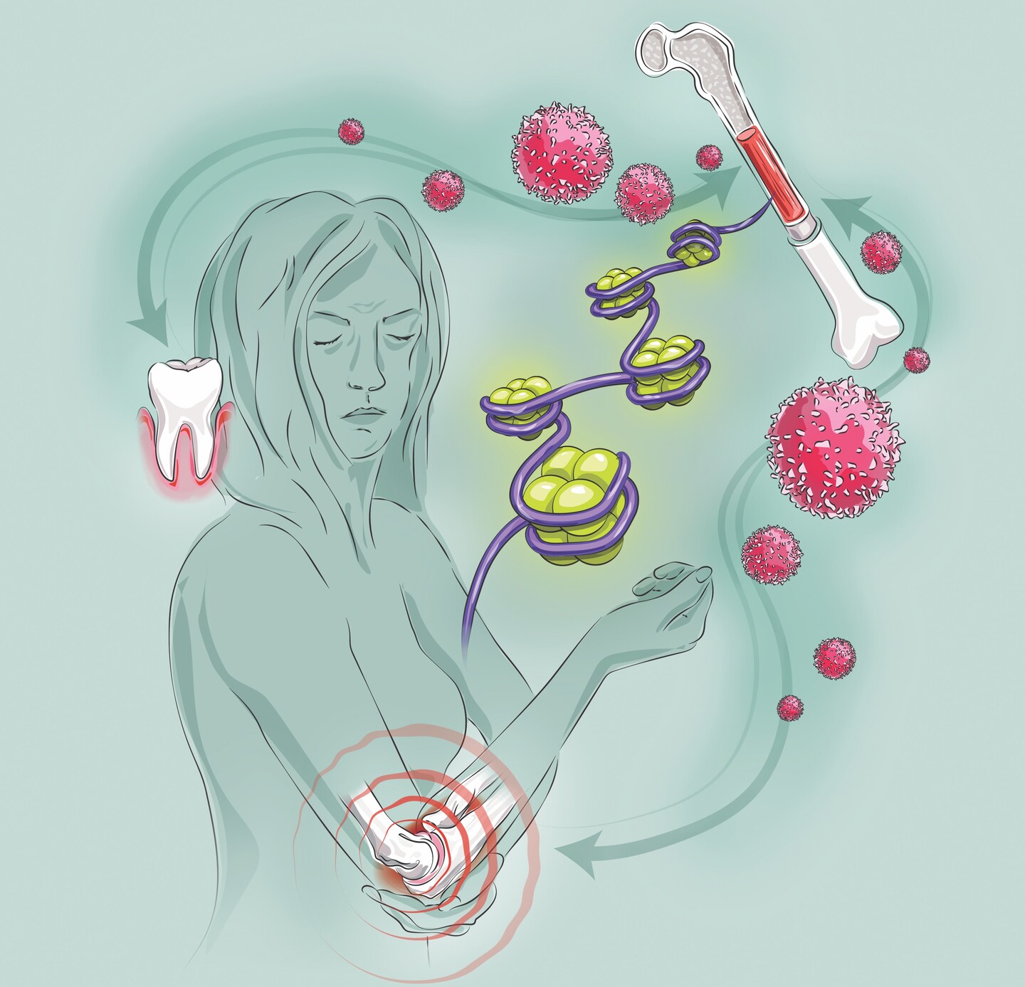 graphic of a person with both gum inflammation and arthritis in an elbow, showing the cells involved in the relationship between the two conditions