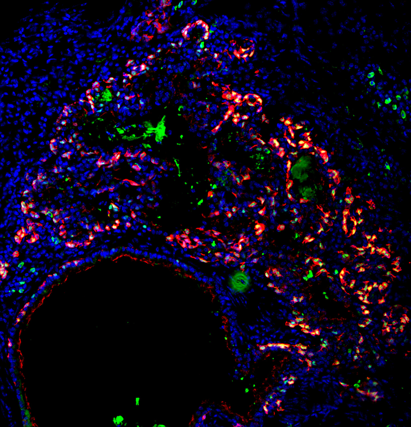 Microscopic image of lung with cells labeled in blue, red, and green