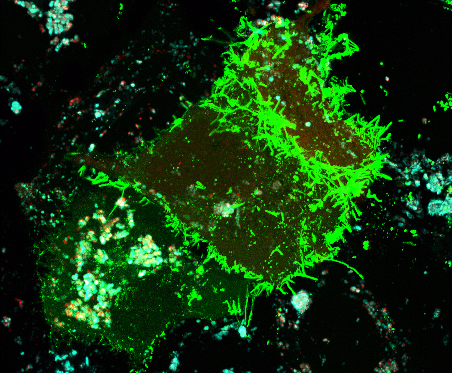 fluorescent microscopic image of two cells being infected with virus