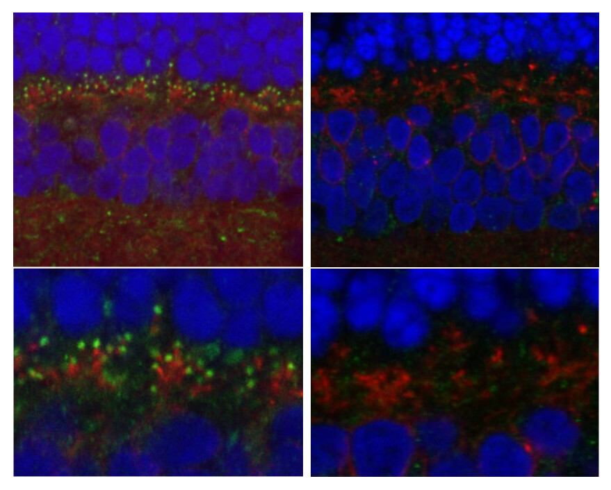 four panels of cellular molecules highlighted by fluoroscopy. Right panels show fewer bright green dots but otherwise look similar to those on the left.