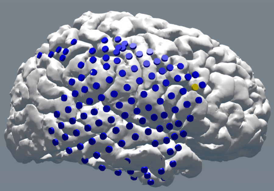 Electrical stimulation delivered when memory is predicted to fail can improve memory function in the human brain.