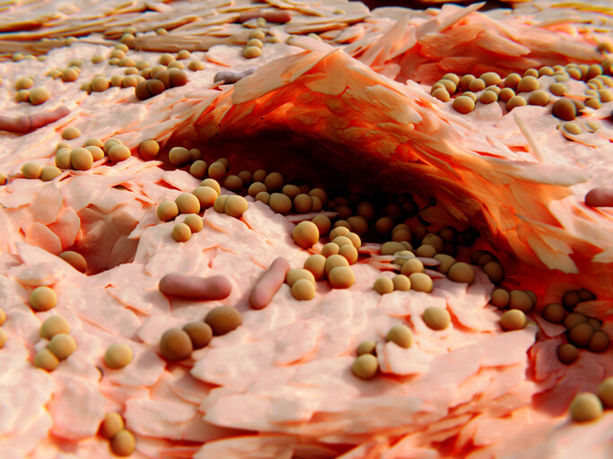 Microscopic view of Staphylococcus aureus.