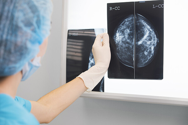nurse in surgery outfit is holding a mammogram in front of x-ray illuminator