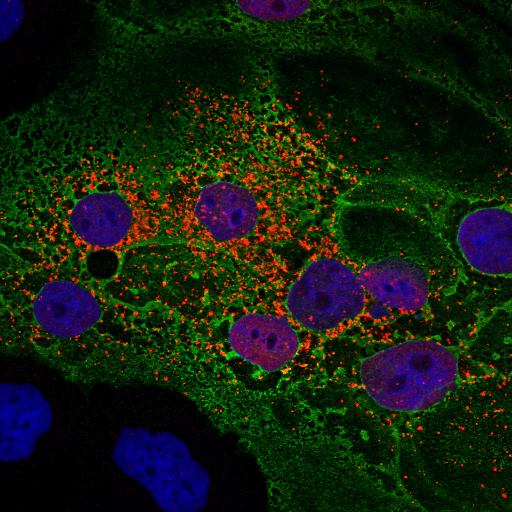 microscopic image of covid-19