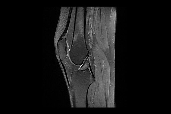 X-ray of human knee joint.