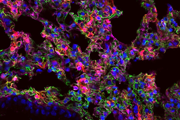 Microscopic view of  lung cells expressing the synthetic mRNA