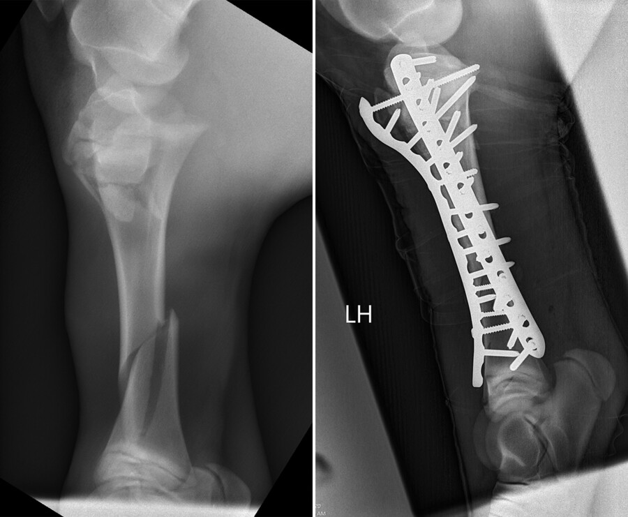 before and after surgery