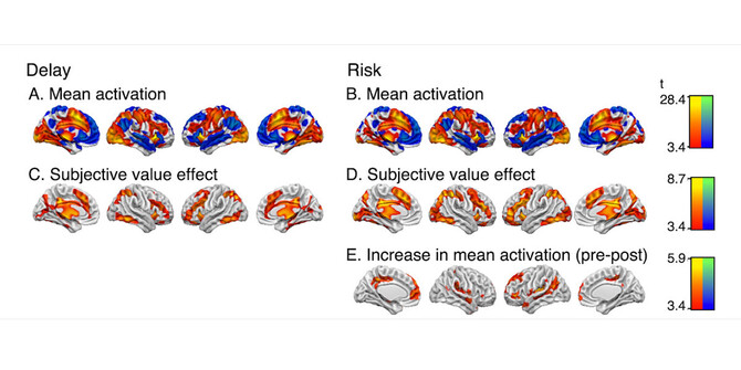 brain activity