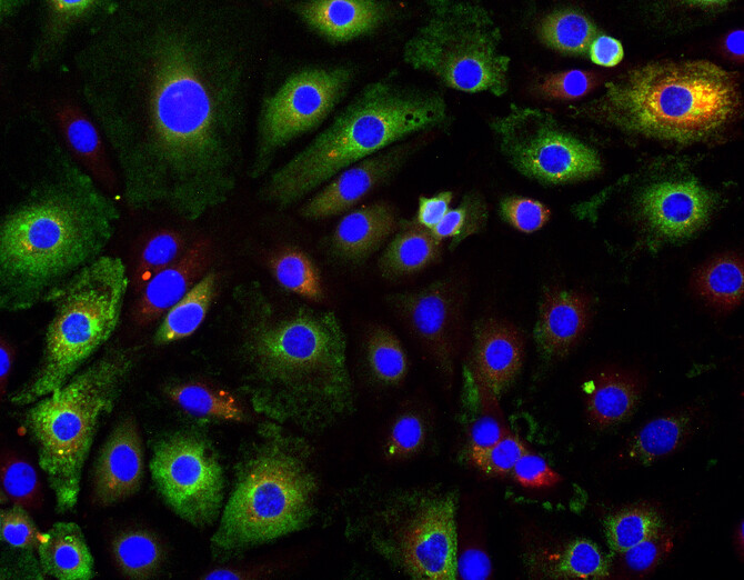 Defective viral genomes