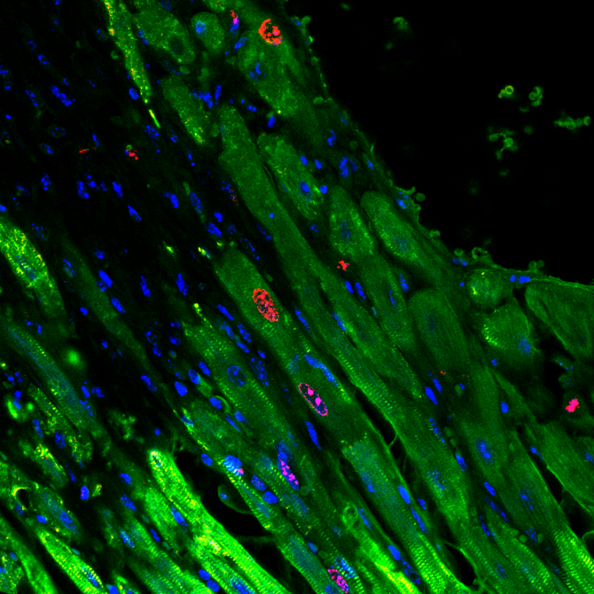 AKB hydrogel day5-4.png AKB hydrogel day5-4.png