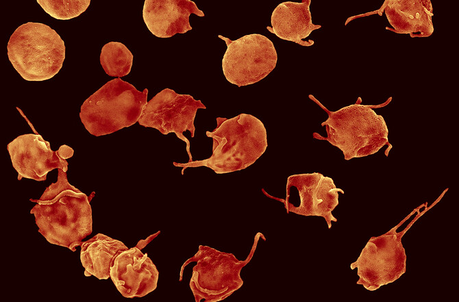 Activated platelets with filopodia Activated platelets with filopodia