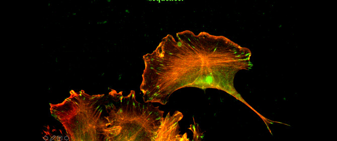 Actin cytoskeleton Actin cytoskeleton