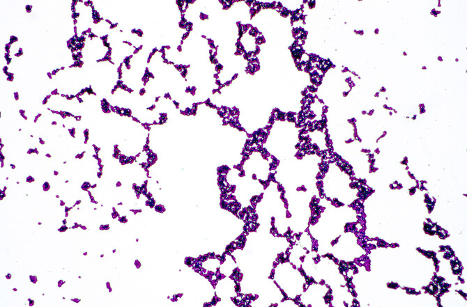 Gram stain of Staphylococcus on skin