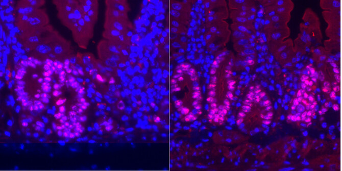 Intestinal stem cells under calorie restriction